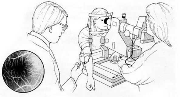 Флуоресцентная ангиография сетчатки