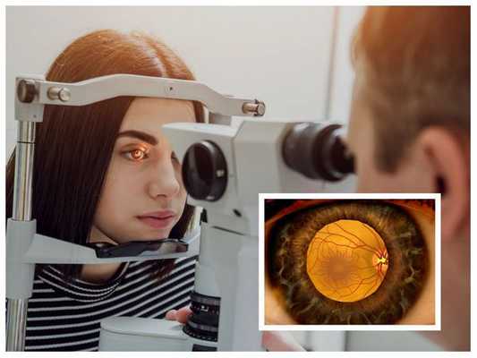 Офтальмоскопия