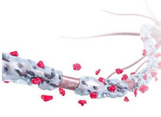 Разрушение миелиновой оболочки