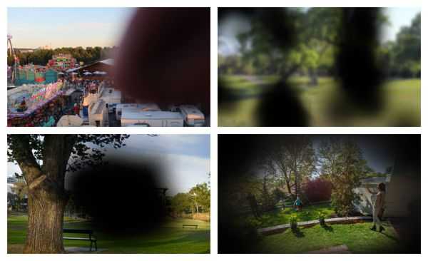 Варианты выпадения поля зрения