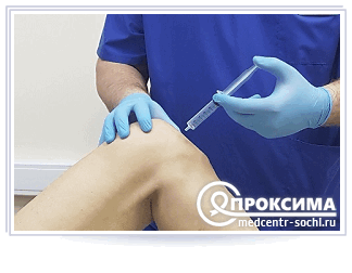 Пункция синовиальной сумки сустава