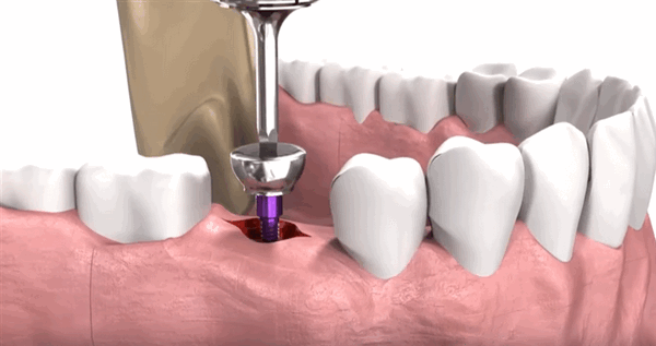 Снять заглушку