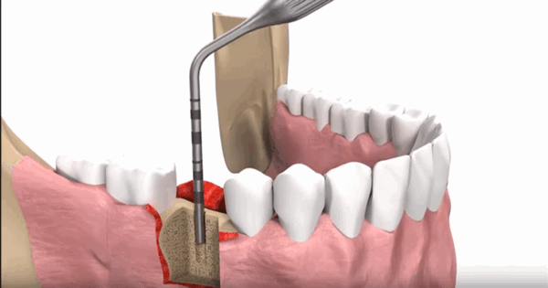 Глубина канала