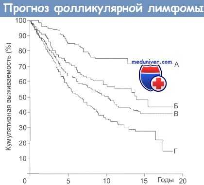 Прогноз фолликулярной лимфомы
