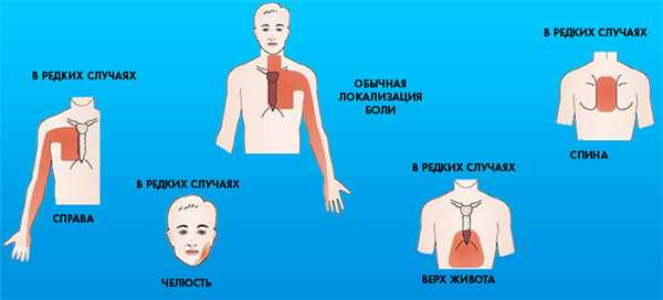 Симптомы стенокардии