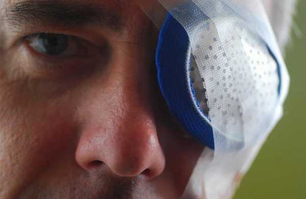 рекомендации после удаления катаракты