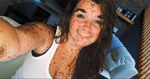 Множество родинок