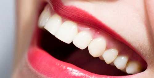 vosstanovleniye verhnih rezcov