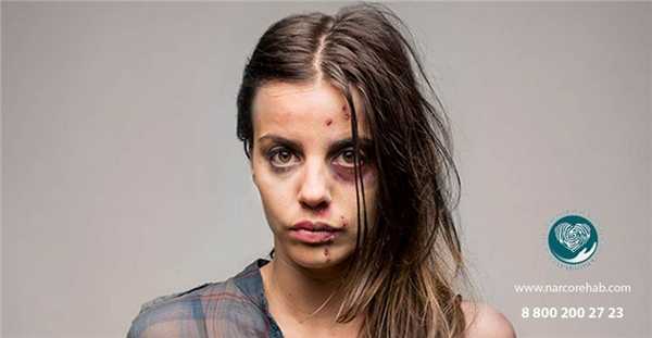 Фото наркомана