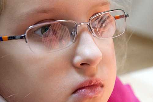 Очки с наклеенными призмами Френеля