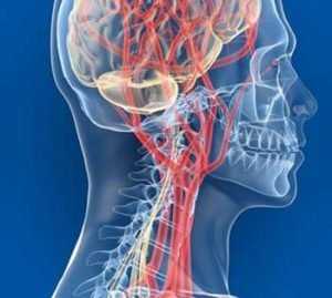 Нейро-циркуляторная дистония 