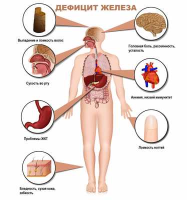 Дефицит железа.jpg