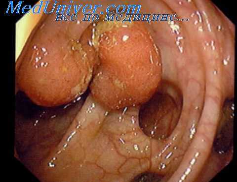 диагностика заболеваний