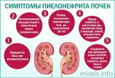 Как проявляется пиелонефрит