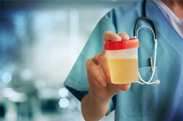 Расшифровка анализов мочи: что указывает на болезни почек?