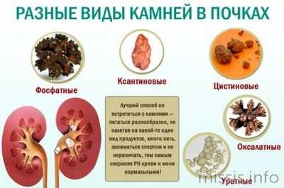 Разные виды камней