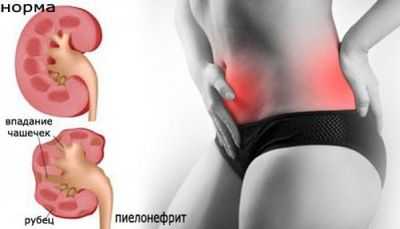 Особенности патологии у женщин