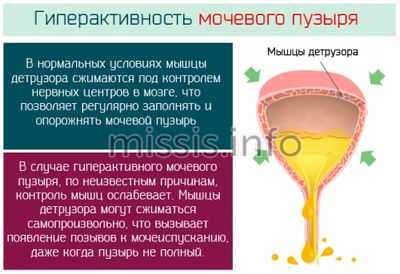 Причины частых позывов к мочеиспусканию