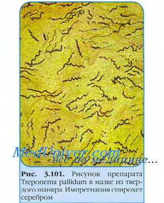 Признаки сифилиса. Клинические проявления сифилиса. Клиника сифилиса. Триада Хатчинсона