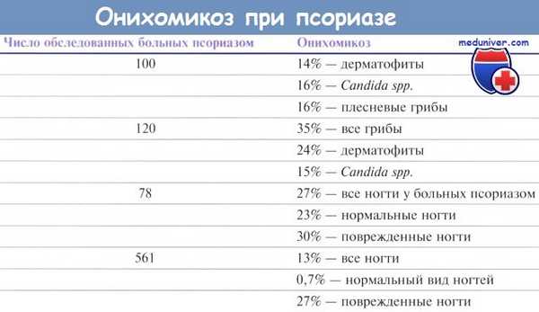 Онихомикоз (грибок ногтей) при псориазе