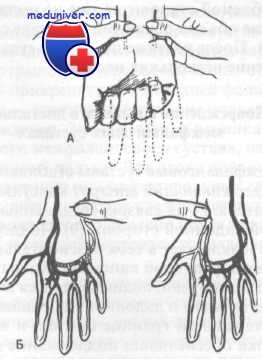 травма сосудов кисти