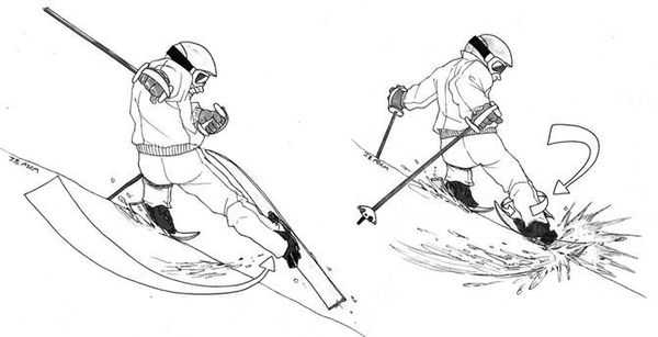 Фантом стопы [14]