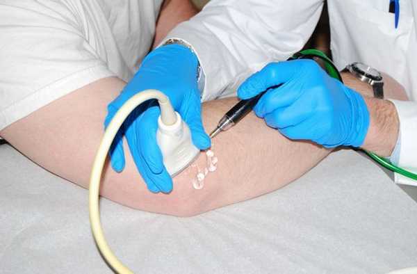 Физиотерапия