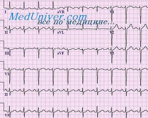 физическая нагрузка