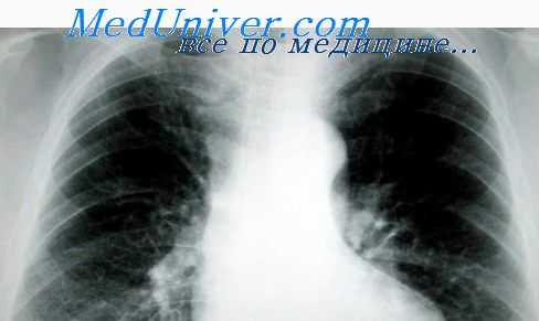 введение туберкулина