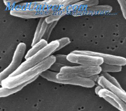 туберкулинодиагностика