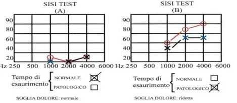 феномен выравнивания громкости звука-2