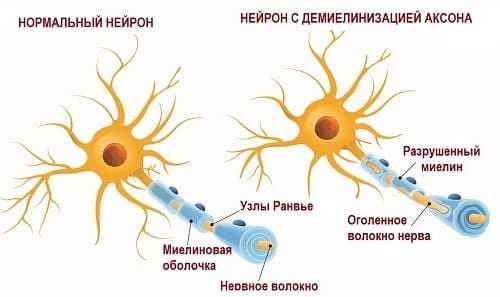 Нервное волокно в миелине и без него