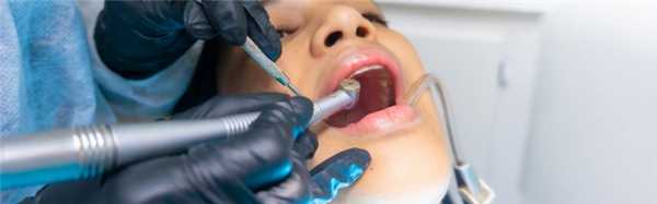 Современное протезирование для безупречной улыбки