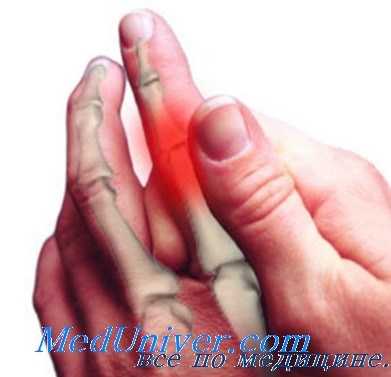 профессиональные невриты руки