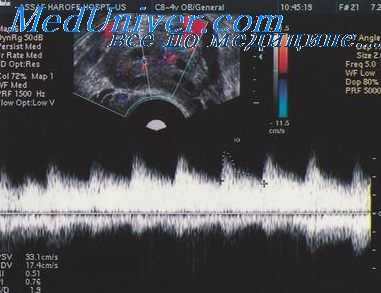 профилактика гестоза