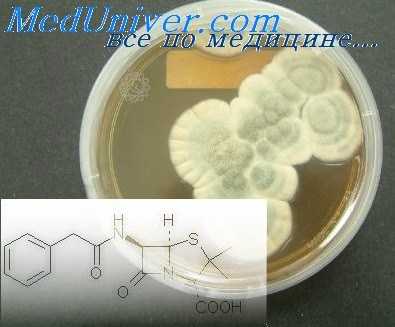 отогенный менингит