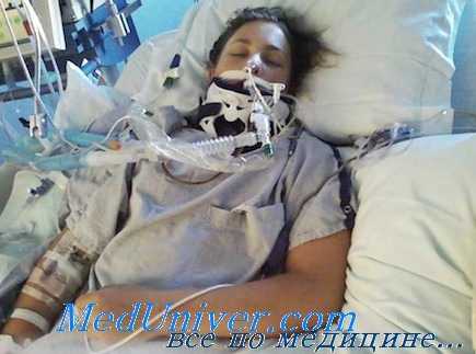 субарахноидальное кровоизлияние