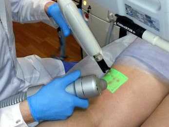 Криолазер - криосклеро (CLACS)