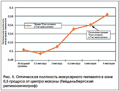 Рис. 5. Оптическая плотность макулярного пигмента в зоне 0,5 градуса от центра макулы (Гейдельбергский ретиноангиограф)