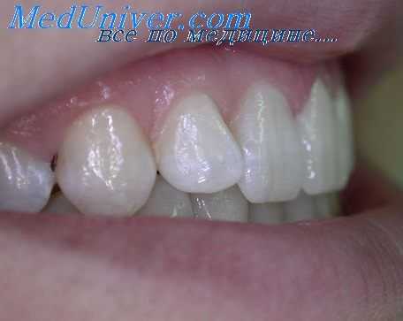 ортопедическая аппаратура