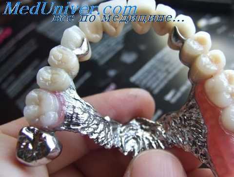 зубной протез