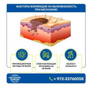 Меланома выживаемость