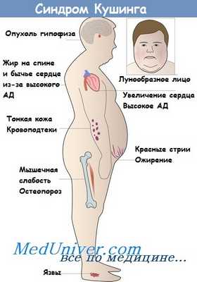 болезнь кушинга