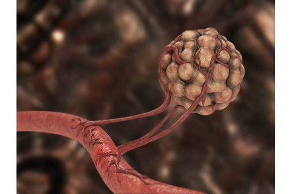 Автономный рост и прогрессия опухолей