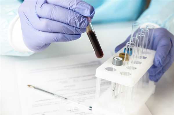 You are currently viewing Пролактин — анализ, нормы, расшифровка результатов теста