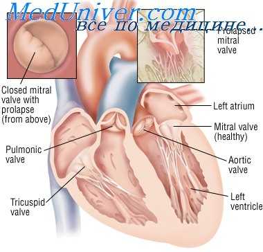 эластическая псевдоксантома