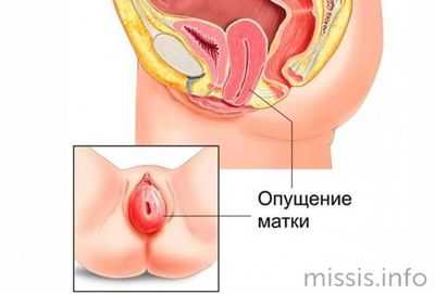 Как выглядит патология