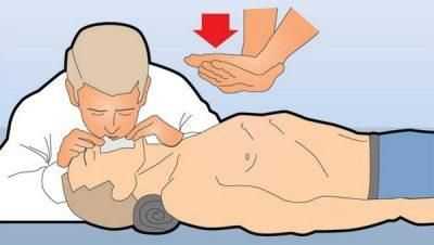 Искусственное дыхание