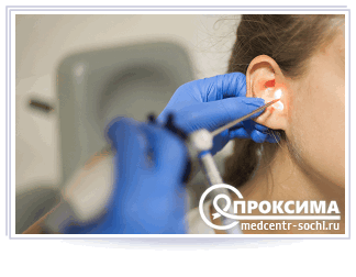 Когда назначают туалет уха при хроническом отите 