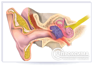 Туалет уха при хроническом отите